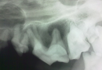 Granuloma apicale presentazione radiografica